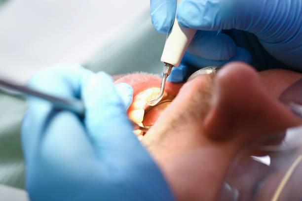Best Broken Tooth Emergency  in Newport, VT