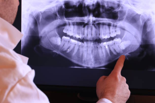 Best Broken Tooth Emergency  in Newport, VT
